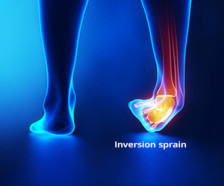 Inversion sprain